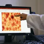 الموافقة على دواء جديد يضاعف أعمار مرضى سرطان البنكرياس