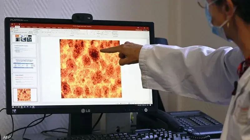 عقار "داراكسونراسيب" يستهدف طفرات جين "راس" العصية وخفّض خطر الوفاة بنسبة 60% في التجربة السريرية