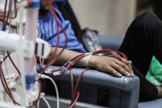 مركز حقوقي يحذر من خطر يهدد حياة 650 مريض فشل كلوي في قطاع غزة