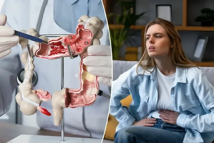 تقليل استهلاك الأطعمة فائقة المعالجة قد يقلل الإصابة بمقدمات سرطان القولون المبكر