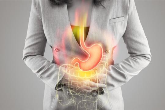 حرقة المعدة المستمرة قد تتحول إلى خطر قبل السرطان