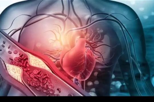 المشروبات السكرية تهدد صحة القلب.. كيف ترفع الدهون الثلاثية؟