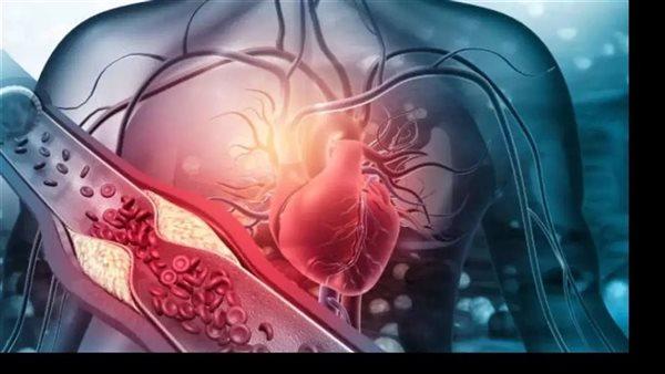 دراسات تكشف ارتباطًا قويًا بين استهلاك السكر السائل وزيادة مخاطر أمراض القلب