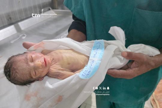 وفاة الرضيع أسعد عابدين نتيجة البرد الشديد جنوب القطاع