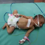 بعد علاجهم خارج القطاع .. توقع وصول 8 أطفال خدّج إلى غزة عبر معبر رفح