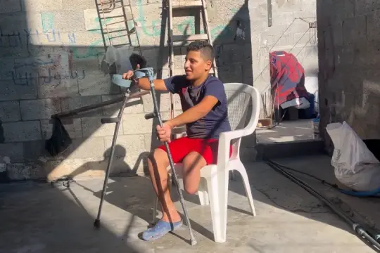 كارثة إنسانية متفاقمة.. 8 آلاف حالة بتر بغزة منذ بدء الحرب