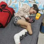 صحة غزة: وضعًا صادمًا يعصف بالجرحى من مبتوري الأطراف في القطاع