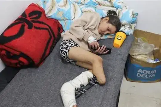 صحة غزة: وضعًا صادمًا يعصف بالجرحى من مبتوري الأطراف في القطاع