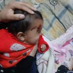 إصابة رضيعة فلسطينية في هجوم لمستوطنين على منازل شمال الخليل