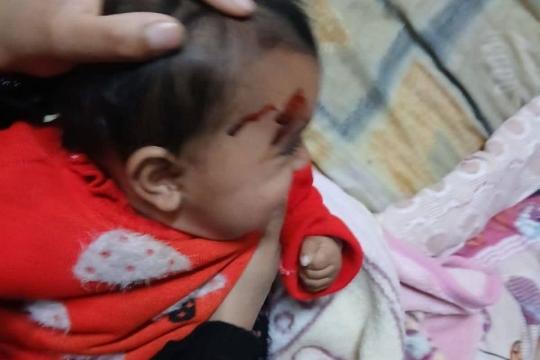 إصابة رضيعة فلسطينية في هجوم لمستوطنين على منازل شمال الخليل
