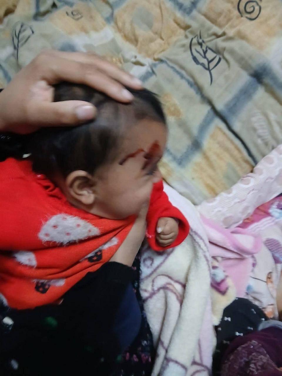 اعتداء بالحجارة على منازل وممتلكات المواطنين وتصعيد خطير في هجمات المستوطنين