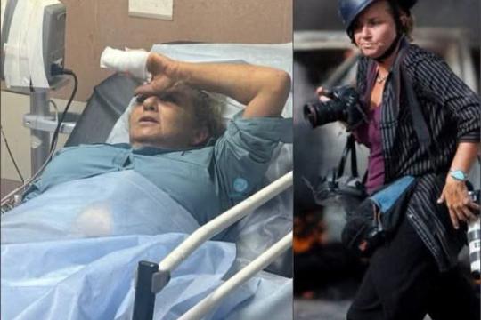 إسرائيل تشكك في ملابسات واقعة الاعتداء على مصورة «واشنطن بوست» قرب أبو فلاح وتعلن فتح تحقيق
