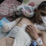 42 ألف شخص في قطاع غزة يعانون إصابات غيّرت مجرى حياتهم