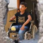 الحرب على غزة تخلّف 6 آلاف مبتور.. وقطاع الصحة على حافة الانهيار