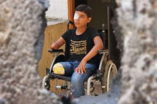 الحرب على غزة تخلّف 6 آلاف مبتور.. وقطاع الصحة على حافة الانهيار