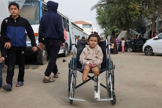 8 آلاف مبتور الأطراف في غزة.. نقص المواد يعرقل إعادة التأهيل
