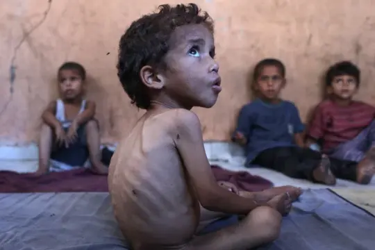 أزمة صحية حادة في غزة.. مستشفى شهداء الأقصى تحذر من كارثة وشيكة