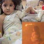 مريم نجت من الحريق بجسدها.. فهل تنجو من ذاكرة احتراق أمها؟
