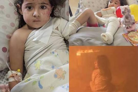 مريم نجت من الحريق بجسدها.. فهل تنجو من ذاكرة احتراق أمها؟