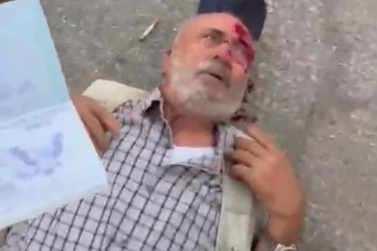 إصابة مسن باعتداء قوات الاحتلال عليه شمال رام الله