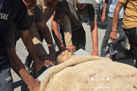 شهيد و10 مصابين في قصف إسرائيلي استهدف خيام النازحين بمواصي خان يونس
