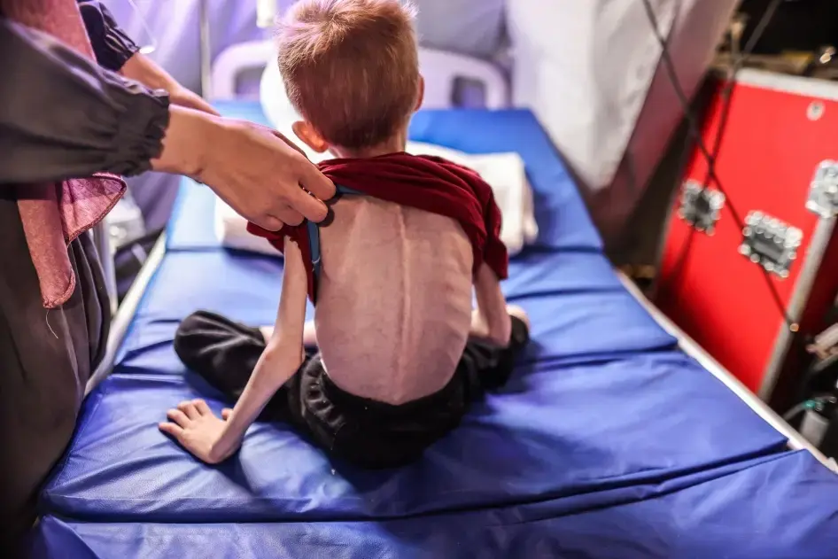 لجنة أممية تدين استخدام تجويع الأطفال في غزة سلاح حرب