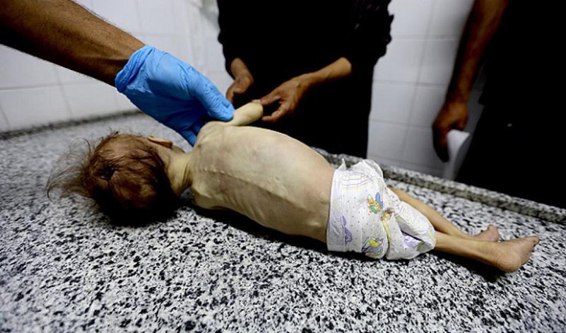 منظمات إغاثة بغزة: إسرائيل تعرقل إدخال مواد غذائية للأطفال الرضع وتتسبب بوفاتهم