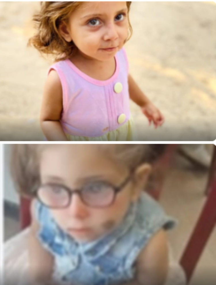 الطفلة الغزية سيلا قد تفقد بصرها بسبب إغلاق المعابر