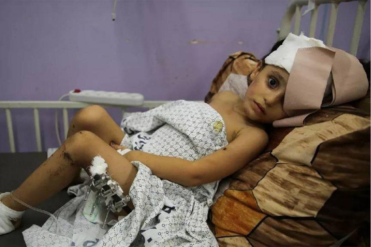 مستشفى العيون: تسجيل 1200 حالة جديدة فقدت البصر كليا أو جزئيا