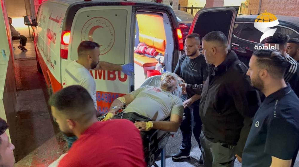 إصابة شاب مقدسي بقنبلة صوت في الرأس خلال اقتحام بلدة الرام