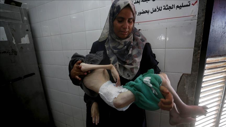 الصحة العالمية: وفاة 99 فلسطينيا بسوء التغذية في غزة منذ مطلع العام