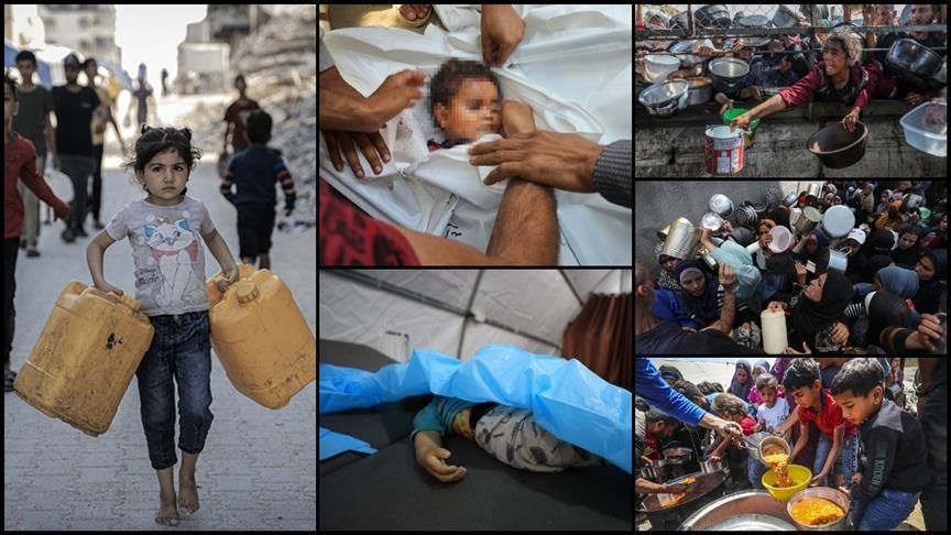 غزة تموت جوعا.. الأونروا تدعو لرفع الحصار لإنهاء المجاعة