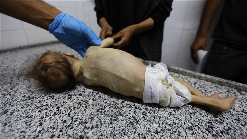 الإعلام الحكومي: الموت جوعا يهدد 650 ألف طفل دون الخامسة بالقطاع