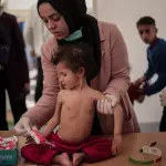 تحذيرات طبية من تفاقم كارثة سوء التغذية بين أطفال غزة