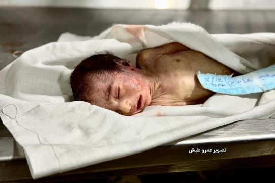 وفاة الرضيع أسعد عابدين نتيجة البرد الشديد جنوب القطاع .. صور