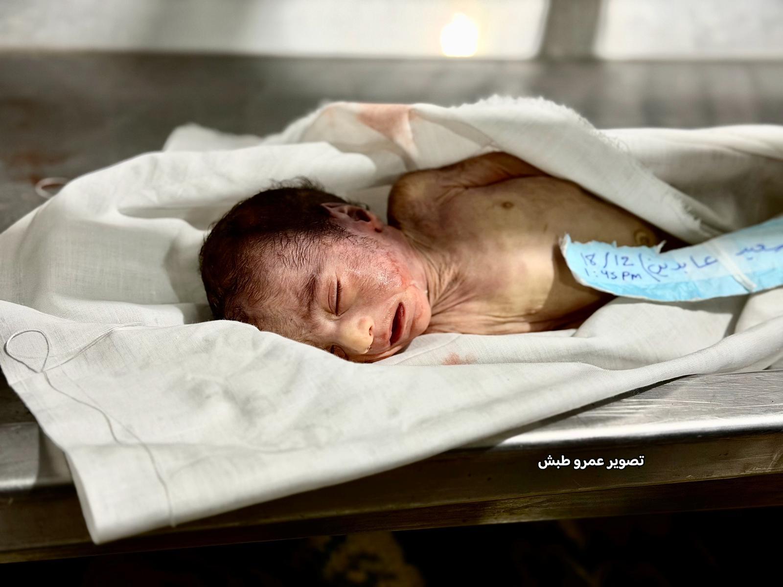 يرفع العدد لـ13