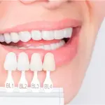 طرق طبيعية وآمنة لتحسين بياض الأسنان دون الحاجة للعيادات