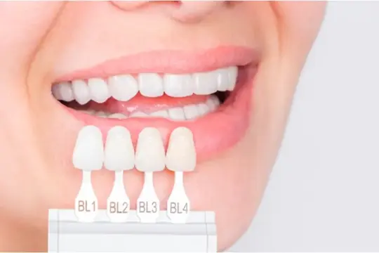 طرق طبيعية وآمنة لتحسين بياض الأسنان دون الحاجة للعيادات