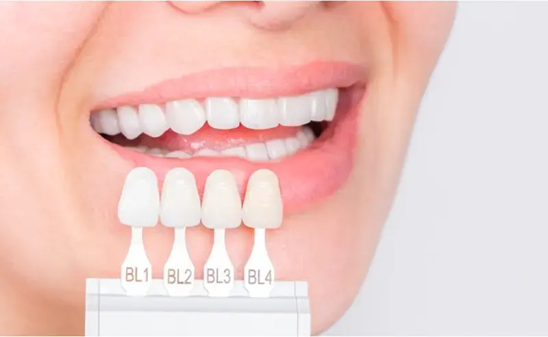 من تنظيف الأسنان المنتظم إلى بيروكسيد الهيدروجين: ما ينفع وما لا ينفع