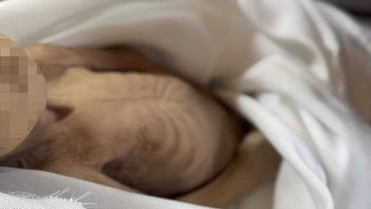 وزارة الصحة تحذر من ولادات غير آمنة وارتفاع وفيات الأجنة وحديثي الولادة