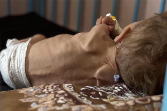 اليونيسف: طفل من كل 5 بغزة يعاني من نقص بالوزن عند الولادة