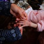 أطفال الحرب.. تشوهات وألم يرافق أول نفس في غزة