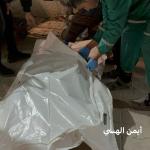 شهيد وعدة إصابات في قصف إسرائيلي على مدينة غزة