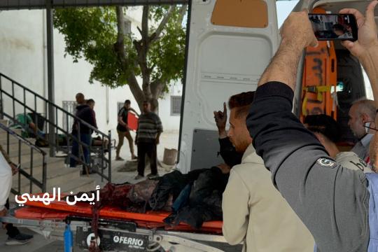 شهيدين وإصابة آخرين في قصف إسرائيلي شمال غزة