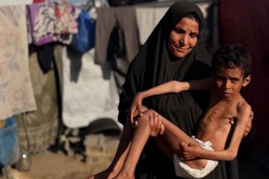 جسدٌ هزيل وصرخةٌ صامتة.. حكاية الطفل محمد السوسي