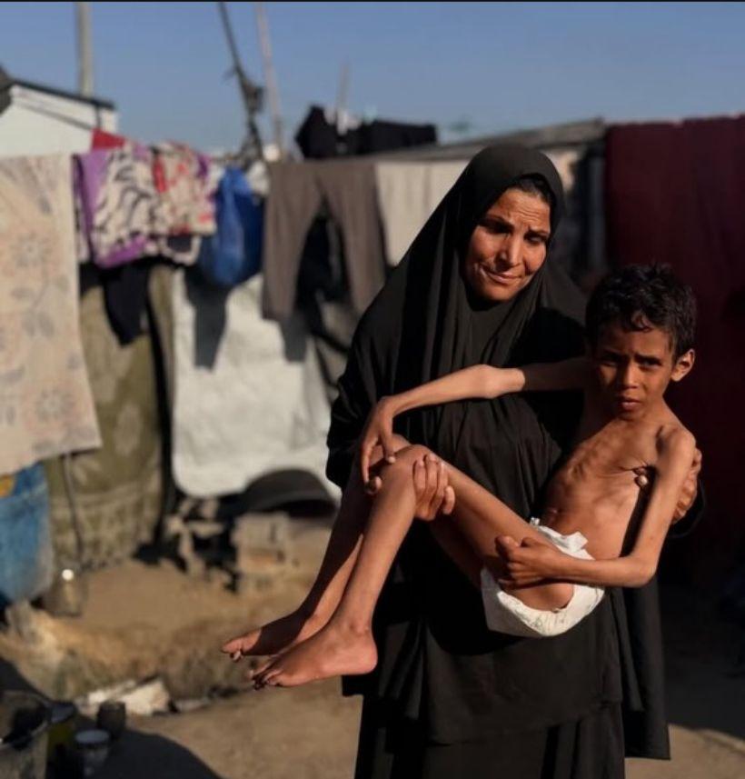أسرة الطفل تناشد توفير العلاج والغذاء والدعم الطبي في ظل ظروف إنسانية صعبة