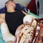 مخلفات الحرب… قنابل موقوتة تلاحق أرواح المدنيين في غزة
