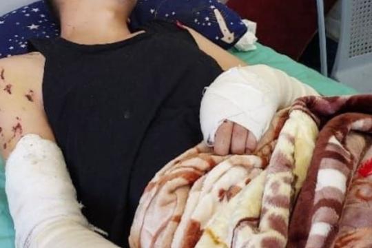 مخلفات الحرب… قنابل موقوتة تلاحق أرواح المدنيين في غزة