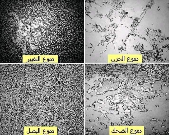 دموع العين تحت المجهر عالم من الجمال الخفي