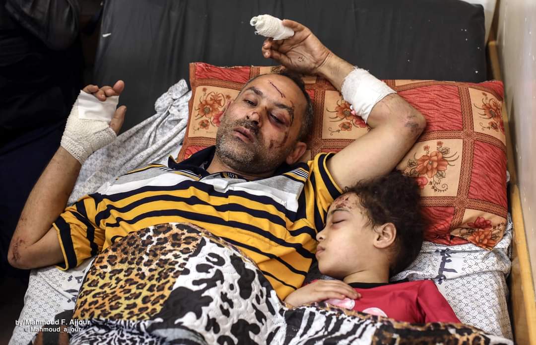 ناجٍ من تحت الأنقاض يروي تفاصيل مروعة عن مجزرة شارع الوحدة
